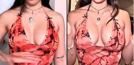 Natural Ways to Fix Uneven Breasts: From Simple to Surgical Options