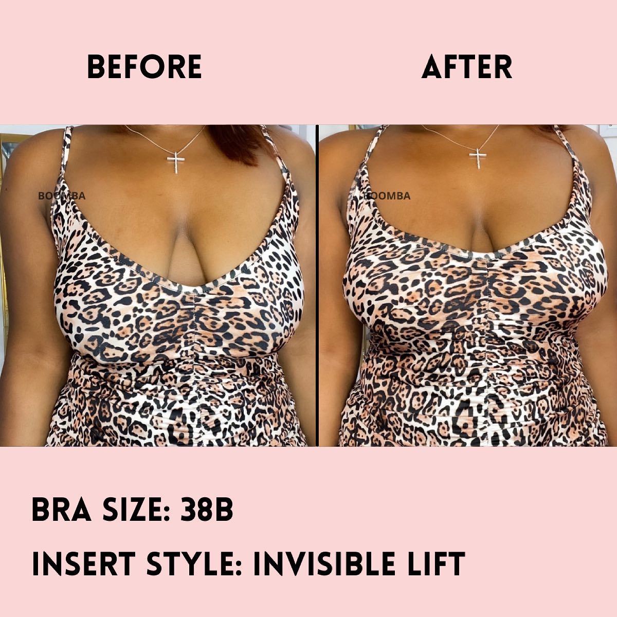 Invisible Lift Inserts